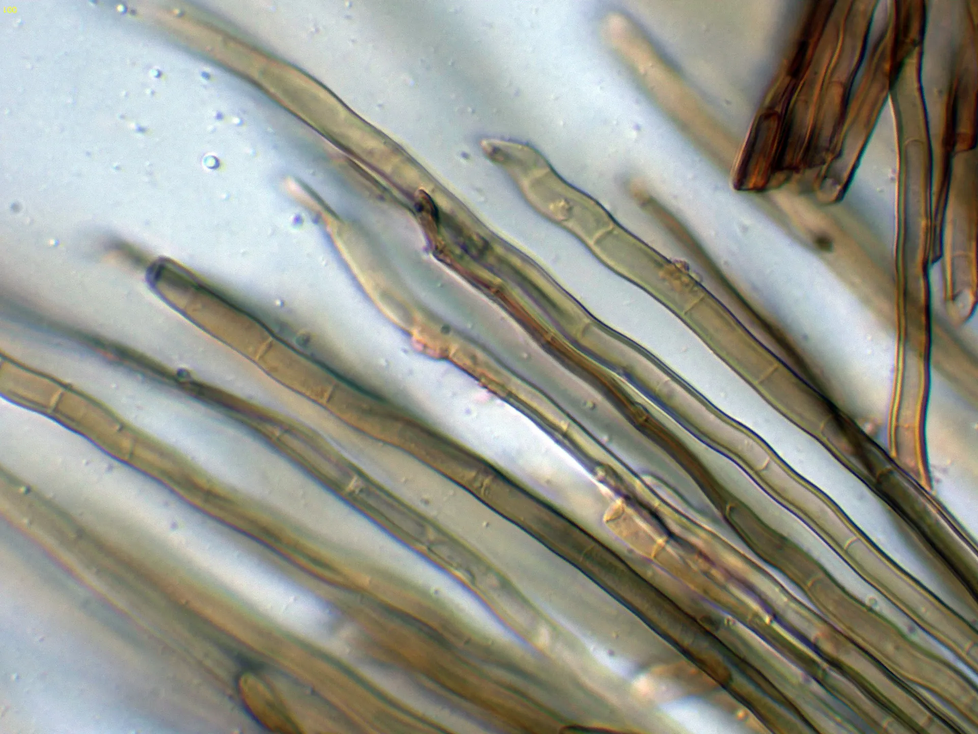 11 - Elementos setiformes pileo-001